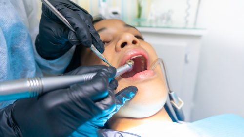 dental drills Features & Benefits of Angular Contact Bearings